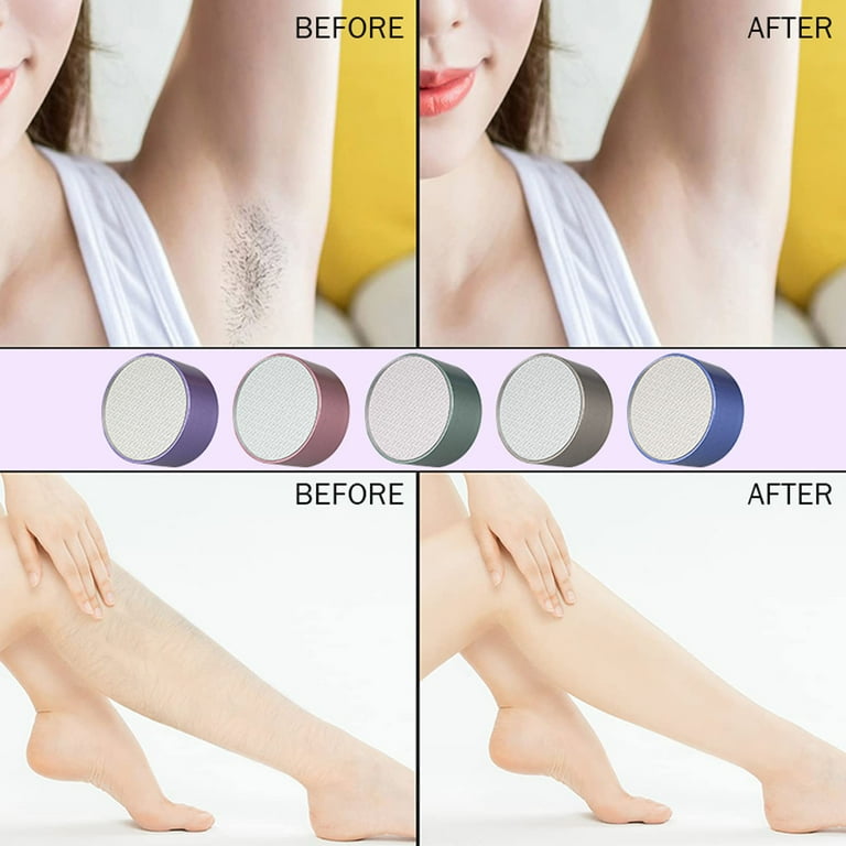 Nano epilator